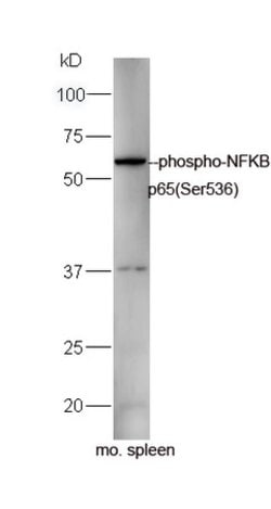 Phospho-NFKB p65 (Ser536) Rabbit anti-Human, Polyclonal, Bioss 100 &mu;L;