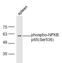 Phospho-NFKB p65 (Ser536) Rabbit anti-Human, Polyclonal, Bioss 100 &mu;L;