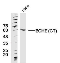 BCHE CT Rabbit anti-Human, Polyclonal, Bioss 100 &mu;L; Unconjugated:Antibodies,