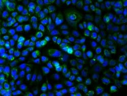 c-Kit Rabbit anti-Human, Polyclonal, Bioss 100 &mu;L; Unconjugated:Antibodies,