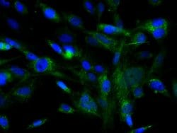 c-Kit Rabbit anti-Human, Polyclonal, Bioss 100 &mu;L; Unconjugated:Antibodies,