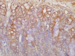 c-Kit Rabbit anti-Human, Polyclonal, Bioss 100 &mu;L; Unconjugated:Antibodies,