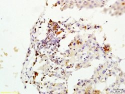 MGMT Rabbit anti-Human, Polyclonal, Bioss 100 &mu;L; Unconjugated:Antibodies,