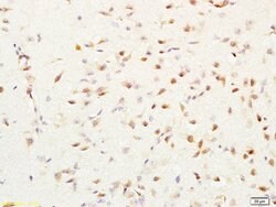MGMT Rabbit anti-Human, Polyclonal, Bioss 100 &mu;L; Unconjugated:Antibodies,