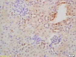 NFKB p100/p52 Rabbit anti-Human, Polyclonal, Bioss 100 &mu;L; Unconjugated:Antibodies,