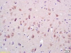 GluR1, GluR2 Rabbit anti-Human, Polyclonal, Bioss 100 &mu;L; Unconjugated:Antibodies,