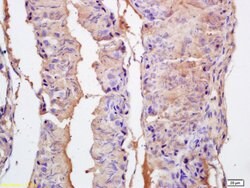 EPHA10 Rabbit anti-Human, Polyclonal, Bioss 100 &mu;L; Unconjugated:Antibodies,