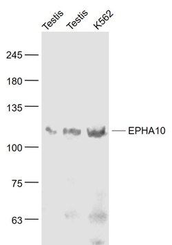 EPHA10 Rabbit anti-Human, Polyclonal, Bioss 100 &mu;L; Unconjugated:Antibodies,
