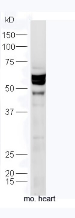 TXA2R Rabbit anti-Human, Polyclonal, Bioss 100 &mu;L; Unconjugated:Antibodies,