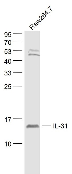 IL-31 Rabbit anti-Human, Polyclonal, Bioss 100 &mu;L; Unconjugated:Antibodies,
