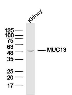 MUC13 Rabbit anti-Human, Polyclonal, Bioss 100 &mu;L; Unconjugated:Antibodies,