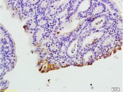 CXCR1 Rabbit anti-Human, Polyclonal, Bioss 100 &mu;L; Unconjugated:Antibodies,