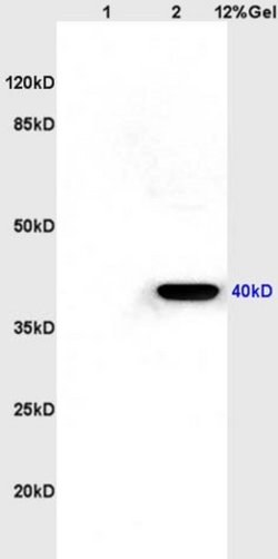 CXCR1 Rabbit anti-Human, Polyclonal, Bioss 100 &mu;L; Unconjugated:Antibodies,
