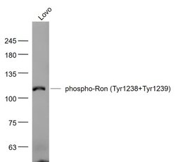 Phospho-Ron (Tyr1238, Tyr1239) Rabbit anti-Human Mouse Rat, Polyclonal, Bioss 100 &mu;L | Buy Online | Bioss | Fisher Scientific