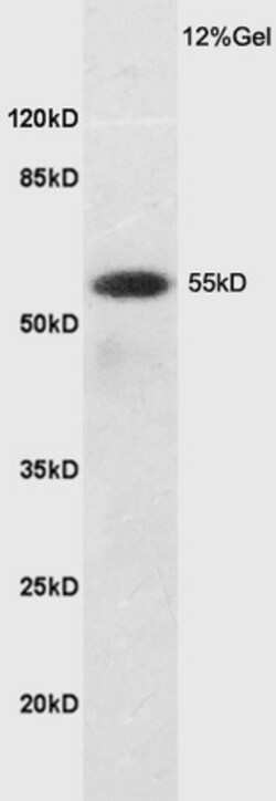 SLC7A5 Rabbit anti-Human, Polyclonal, Bioss 100 &mu;L; Unconjugated:Antibodies,