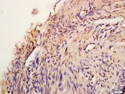 Phospho-AKT1/2/3 (Tyr474) Rabbit anti-Human, Polyclonal, Bioss 100 &mu;L | Buy Online | Bioss | Fisher Scientific