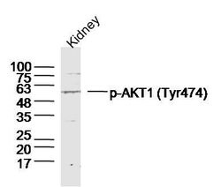 Phospho-AKT1/2/3 (Tyr474) Rabbit anti-Human, Polyclonal, Bioss 100 &mu;L | Buy Online | Bioss | Fisher Scientific
