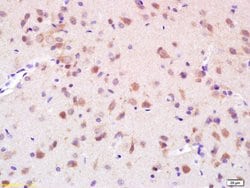 Phospho-Eph receptor B1 (Tyr928) Rabbit anti-Human, Polyclonal, Bioss 100