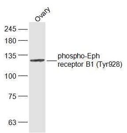 Phospho-Eph receptor B1 (Tyr928) Rabbit anti-Human, Polyclonal, Bioss 100