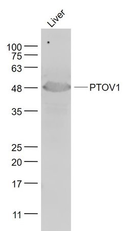PTOV1 Rabbit anti-Human, Polyclonal, Bioss 100 &mu;L; Unconjugated:Antibodies,