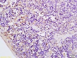 CMKLR1 Rabbit anti-Human, Polyclonal, Bioss 100 &mu;L; Unconjugated:Antibodies,