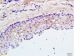 TLR2 Rabbit anti-Human, Polyclonal, Bioss 100 &mu;L; Unconjugated:Antibodies,