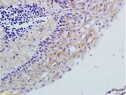 TLR2 Rabbit anti-Human, Polyclonal, Bioss 100 &mu;L; Unconjugated:Antibodies,