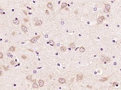 TLR2 Rabbit anti-Human, Polyclonal, Bioss 100 &mu;L; Unconjugated:Antibodies,