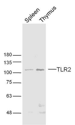 TLR2 Rabbit anti-Human, Polyclonal, Bioss 100 &mu;L; Unconjugated:Antibodies,