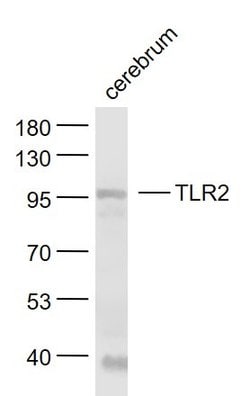 TLR2 Rabbit anti-Human, Polyclonal, Bioss 100 &mu;L; Unconjugated:Antibodies,