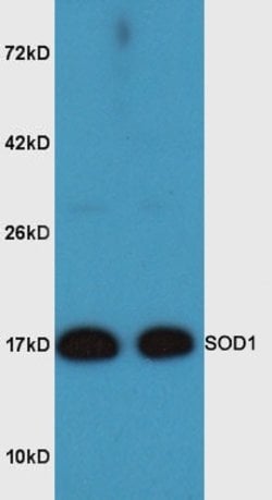 SOD1 Rabbit anti-Human, Polyclonal, Bioss 100 &mu;L; Unconjugated:Antibodies,