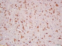 HER4/ErbB4 Rabbit anti-Human, Polyclonal, Bioss 100 &mu;L; Unconjugated:Antibodies,