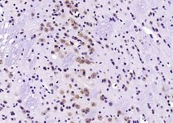 HER4/ErbB4 Rabbit anti-Human, Polyclonal, Bioss 100 &mu;L; Unconjugated:Antibodies,