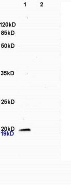 CSF3 Rabbit anti-Human, Polyclonal, Bioss 100 &mu;L; Unconjugated:Antibodies,