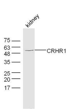 CRHR1 Rabbit anti-Human, Polyclonal, Bioss 100 &mu;L; Unconjugated:Antibodies,