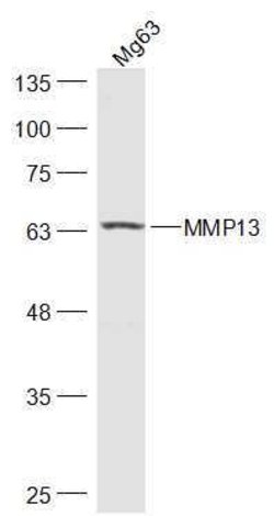 MMP13 Rabbit anti-Human, Polyclonal, Bioss 100 &mu;L; Unconjugated:Antibodies,