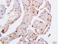 Desmin Rabbit anti-Human, Polyclonal, Bioss 100 &mu;L; Unconjugated:Antibodies,