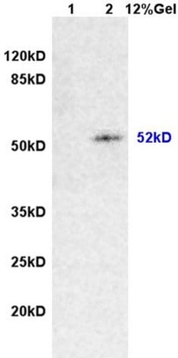 Desmin Rabbit anti-Human, Polyclonal, Bioss 100 &mu;L; Unconjugated:Antibodies,
