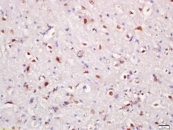 Hrk Rabbit anti-Human, Polyclonal, Bioss 100 &mu;L; Unconjugated:Antibodies,