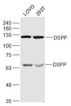 DSPP Rabbit anti-Human, Polyclonal, Bioss 100 &mu;L; Unconjugated:Antibodies,