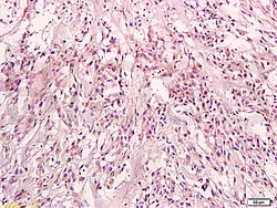KRAS Rabbit anti-Human, Polyclonal, Bioss 100 &mu;L; Unconjugated:Antibodies,
