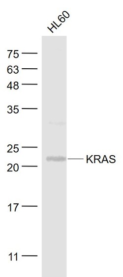 KRAS Rabbit anti-Human, Polyclonal, Bioss 100 &mu;L; Unconjugated:Antibodies,