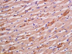 Sarcomeric Alpha Actinin Rabbit anti-Human, Polyclonal, Bioss 100 &mu;L;