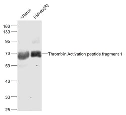Thrombin Activation peptide fragment 1 Polyclonal Antibody, Bioss 100 &mu;L | Buy Online | Bioss | Fisher Scientific