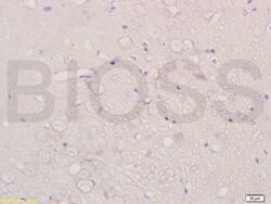CHRNA4 Rabbit anti-Human, Polyclonal, Bioss 100 &mu;L; Unconjugated:Antibodies,