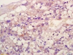 TIMP-2 Rabbit anti-Human, Polyclonal, Bioss 100 &mu;L; Unconjugated:Antibodies,