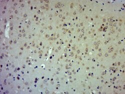 TIMP-2 Rabbit anti-Human, Polyclonal, Bioss 100 &mu;L; Unconjugated:Antibodies,
