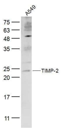 TIMP-2 Rabbit anti-Human, Polyclonal, Bioss 100 &mu;L; Unconjugated:Antibodies,