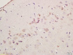 Cyclooxygenase 2 Rabbit anti-Human, Polyclonal, Bioss 100 &mu;L; Unconjugated:Antibodies,
