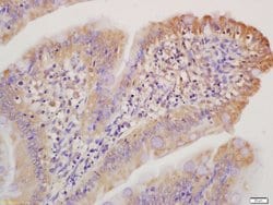 Collagen 1 Rabbit anti-Human, Polyclonal, Bioss 100 &mu;L; Unconjugated:Antibodies,